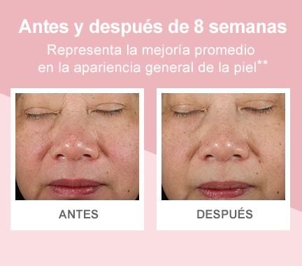 Fotos de “antes” y “después” que demuestran una mejoría en la apariencia general de la piel.