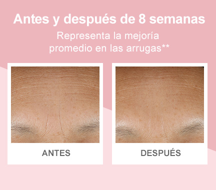 Fotos de “antes” y “después” que demuestran una mejoría en la apariencia general de la piel.